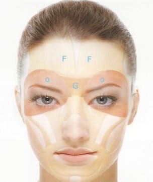Zones d'injections du Botox sur le visage